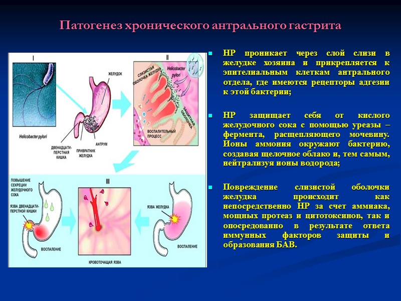 Патогенез хронического антрального гастрита HР проникает через слой слизи в желудке хозяина и прикрепляется